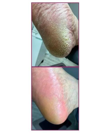 ROSILAK Cream-mask for legs Feeling Cream-Mask - Buy Online on GoSupps.com