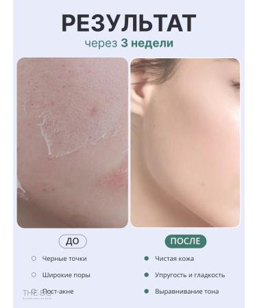 THE:BO Piling Pads for acne discs with salicylic acid - Buy Online on GoSupps.com