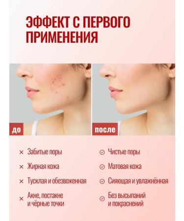 THE:BO Acne serum with AHA and BHA acids - Buy Online on GoSupps.com