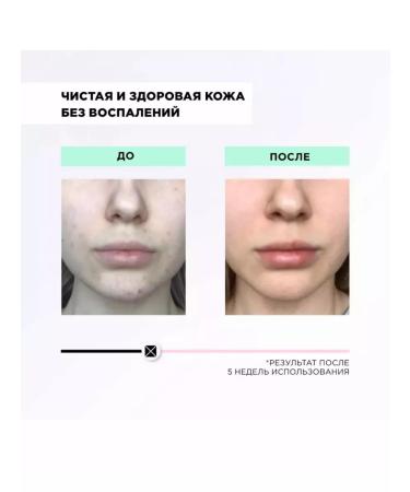 Tender Pilling Gel with Papaya Paeling Gel 100ml Papaya Extract - Buy Online on GoSupps.com