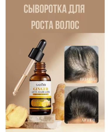 Gold Hair growth serum from hair loss