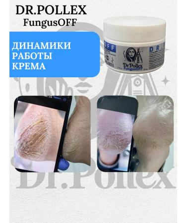 Dr Pollex Cream - balm from cracks on heels and fungus - Buy Online on GoSupps.com