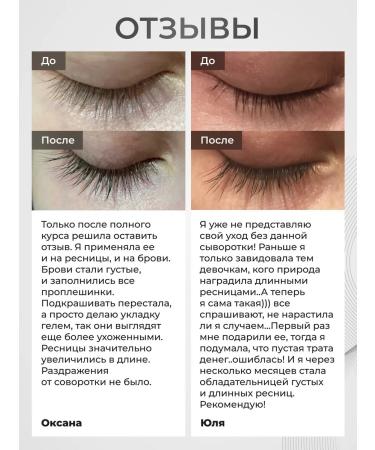 QUEENLASH Serum for eyelash growth and eyebrows 4ml - Buy Online on GoSupps.com