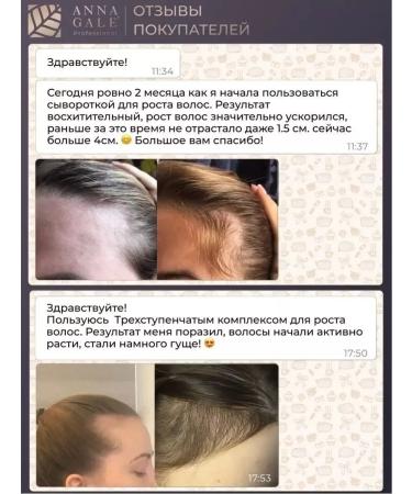 ANNA GALE Night serum for hair growth - Buy Online on GoSupps.com