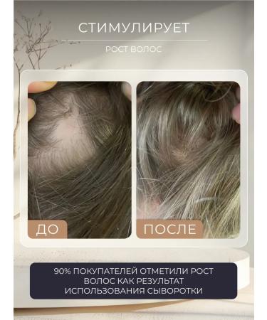 ANNA GALE Night serum for hair growth - Buy Online on GoSupps.com