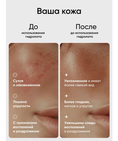 BeSage Hydrolate for face and hair moisturizing spray green tea - Buy Online on GoSupps.com