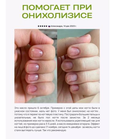 Lengraise CO2 monard oil for nails from onycholysis (30ml + 30ml) - Buy Online on GoSupps.com