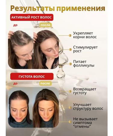 Wellness your hair Hair growth serum - Buy Online on GoSupps.com