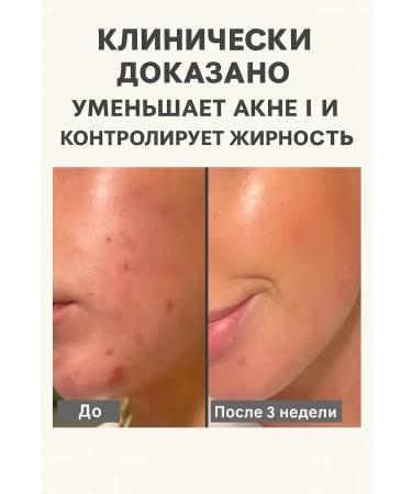 Paula's Choice Liquid exfoliant against acne Skin Perfecting - Buy Online on GoSupps.com