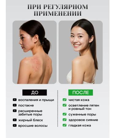 YUSKISS Aha cream with acids against ingrown hair 100 ml - Buy Online on GoSupps.com