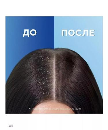 Head and Shoulders Head & shulders shampoo Mentol 800 ml - Buy Online on GoSupps.com