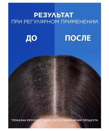 Head & Shoulders Shampoo 2B1 main care 800 ml - Buy Online on GoSupps.com