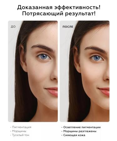 BIOBALANCE Cream - face gel moisturizing against age spots - Buy Online on GoSupps.com