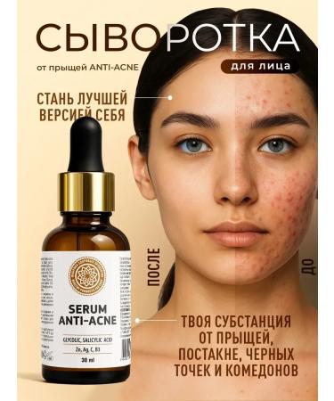 Healthy Products Factory Facial serum from acne and acne