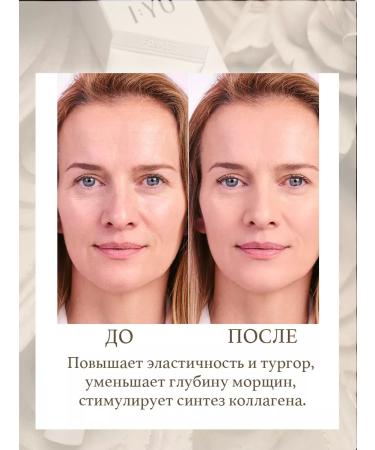 I:YU Face matting BB sunscript moisturizing care - Buy Online on GoSupps.com