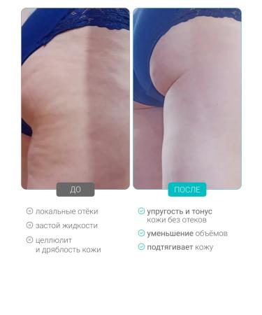 DLYa da KOJi Cryo Body Body Severnice Lights Mini - Buy Online on GoSupps.com