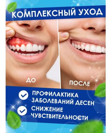 Pearl Toothpaste whitening and against caries set of 3pcs*170g - Buy Online on GoSupps.com