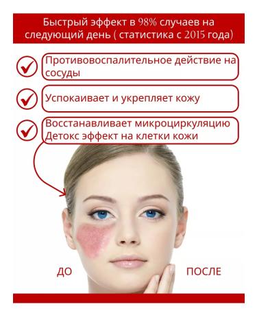 Dr Kirov / Dr Kirov Cosmetic Cream from rosacea rosacea "Tonus capillary of the face" - Buy Online on GoSupps.com