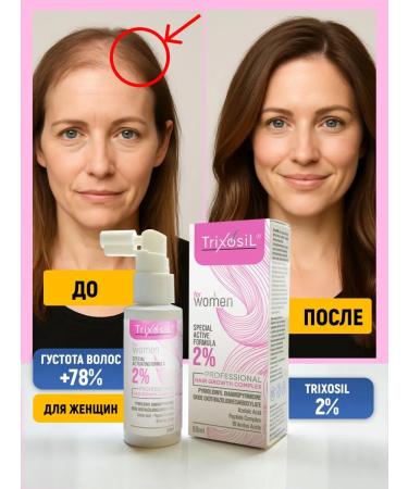 Trixosil Lotion 2% for hair growth against falling out