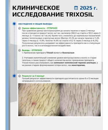 Trixosil Lotion 2% for hair growth against falling out - Buy Online on GoSupps.com