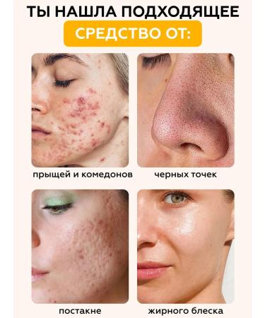 Lefami Salicylic acid acne serum - Buy Online on GoSupps.com