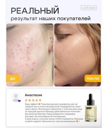Lefami Salicylic acid acne serum - Buy Online on GoSupps.com