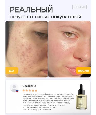 Lefami Salicylic acid acne serum - Buy Online on GoSupps.com