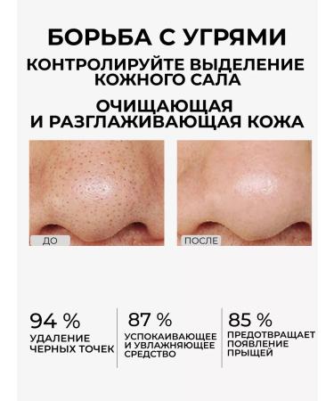 LANBENA Black dots and serum mask - Buy Online on GoSupps.com