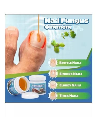 Doril Chinese ointment from nail fungus