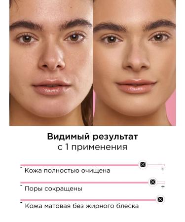 MIXIT Washing gel from black dots and post -acne Your Skin - Buy Online on GoSupps.com