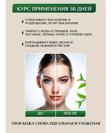 SADOER OFFICIAL Facial cream from acne and acne - Buy Online on GoSupps.com