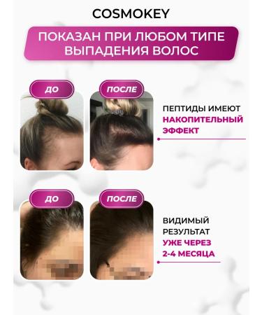Cosmokey Women's serum for growth and from hair loss 50 ml - Buy Online on GoSupps.com