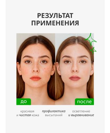 Monica Beauty Facial Lotion What is Clean Anti-Acne 250 ml - Buy Online on GoSupps.com