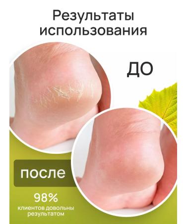 Lokopro Moisturizing body cream - Buy Online on GoSupps.com