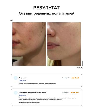 BIOBALANCE SOS Wede from acne and acne dries - Buy Online on GoSupps.com