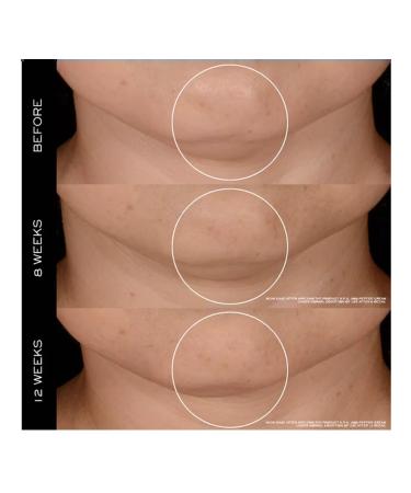 Lancome Renergie recovering anti -aging day cream - Buy Online on GoSupps.com