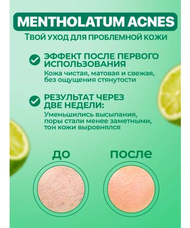 HADA LABO Foam for washing the face against acne 150 ml - Buy Online on GoSupps.com