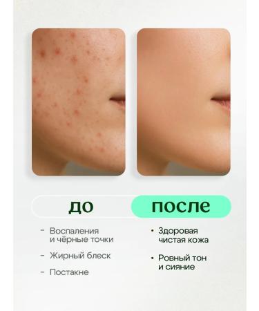 Miss Organic Facial serum from acne and acne with niacinamide and zinc - Buy Online on GoSupps.com