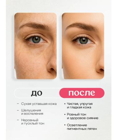 Miss Organic Face peeling with AHA acids from acne 30ml - Buy Online on GoSupps.com