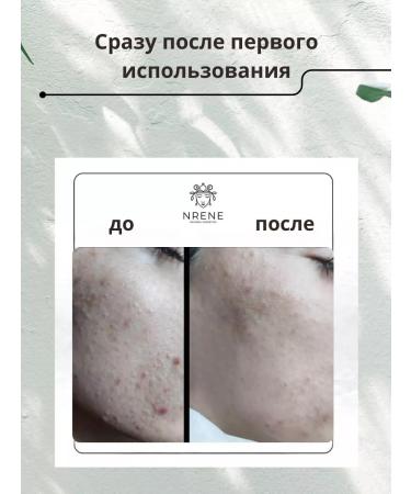 Nrene Natural Cosmetics Piling mask with salicylic acid nrene - Buy Online on GoSupps.com