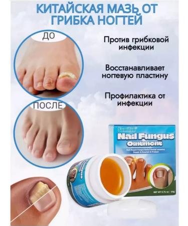 Bronze store Grater for heels with handle with legs ointment - Buy Online on GoSupps.com