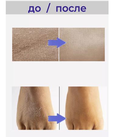 LU MINATE Body cream with urea - Buy Online on GoSupps.com