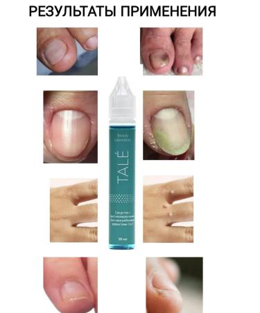 TALE Serum against fungus antiviral warts - Buy Online on GoSupps.com