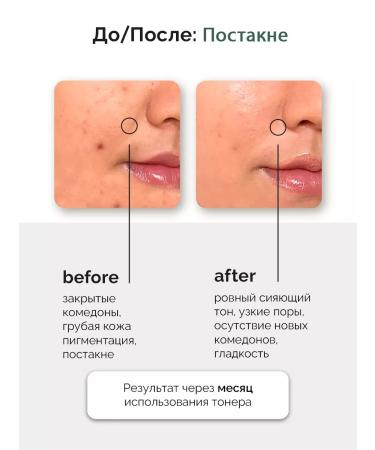 Numbuzin Vitamin Toner No.5 Vitamin Boosting Essence Toner 200 ml - Buy Online on GoSupps.com