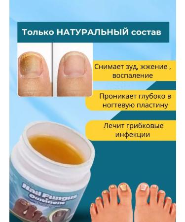Psoriasis Ointment & Psoriasis Cream Chinese remedy for nail fungus 20 g - Buy Online on GoSupps.com