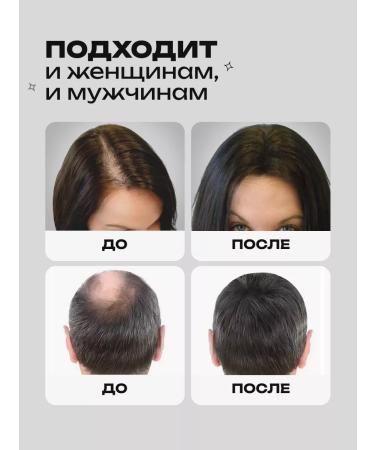 lvcos Hair growth serum 3 1 - Buy Online on GoSupps.com