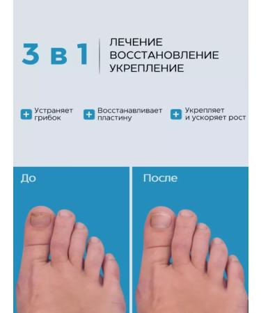 Spirularin Nail nail spiroularin - Buy Online on GoSupps.com