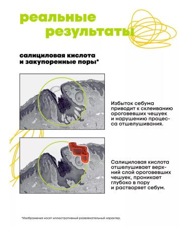 DECODE Face lotion against black dots with salicylic acid - Buy Online on GoSupps.com