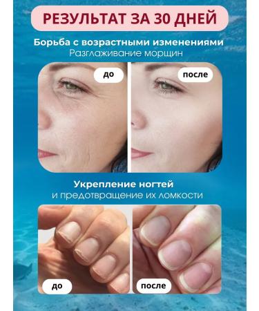 Jinskin Sea collagen in jelly for joints and skin - Buy Online on GoSupps.com