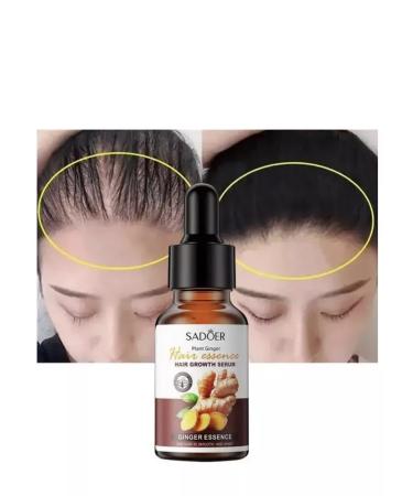 BeeNur Ginger oil for hair growth against falling out